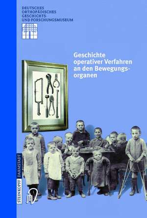 Geschichte operativer Verfahren an den Bewegungsorganen de L. Zichner