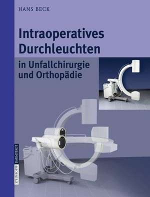 Intraoperatives Durchleuchten in Unfallchirurgie und Orthopädie de Hans Beck