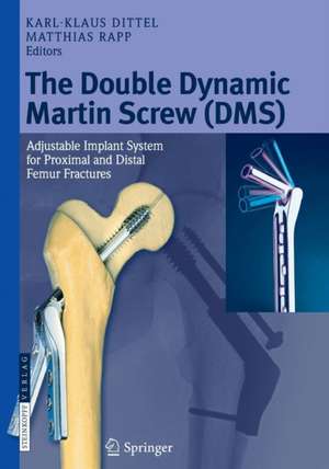 The Double Dynamic Martin Screw (DMS): Adjustable Implant System for Proximal and Distal Femur Fractures de Karl-Klaus Dittel