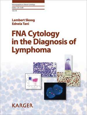 FNA Cytology in the Diagnosis of Lymphoma de E. Tani