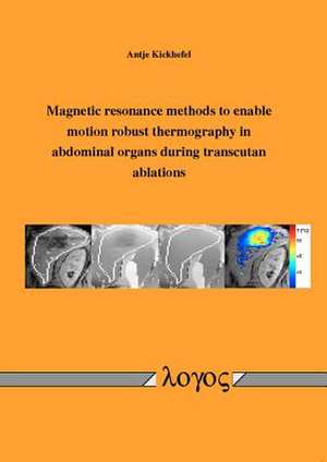 Magnetic Resonance Methods to Enable Motion Robust Thermography in Abdominal Organs During Transcutan Ablations