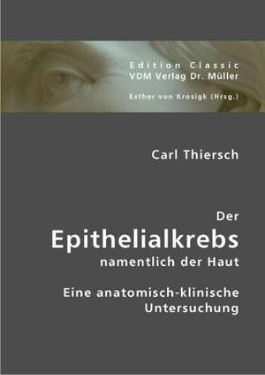 Der Epithelialkrebs namentlich der Haut de Carl Thiersch