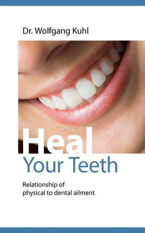 Heal Your Teeth: Der Sizilianer de Wolfgang Kuhl