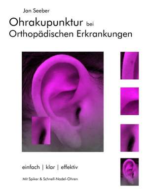 Ohrakupunktur bei Orthopädischen Erkrankungen de Jan Seeber