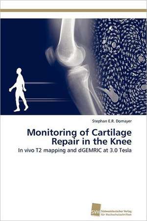 Monitoring of Cartilage Repair in the Knee de Stephan E. R. Domayer