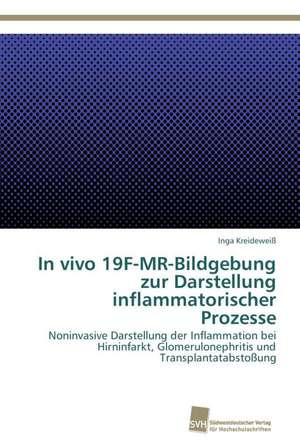 In Vivo 19f-MR-Bildgebung Zur Darstellung Inflammatorischer Prozesse: Measurement and Source Allocation de Inga Kreideweiß