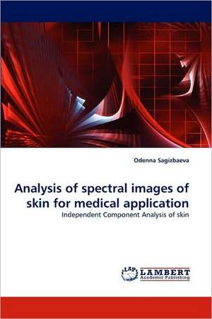 Analysis of spectral images of skin for medical application de Odenna Sagizbaeva