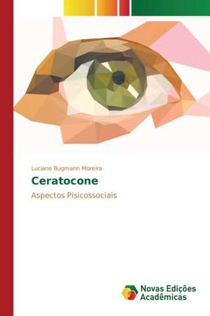 Ceratocone de Luciane Bugmann Moreira