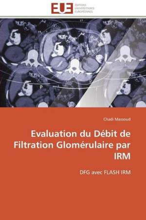 Evaluation Du Debit de Filtration Glomerulaire Par Irm: France Et Russie de Chadi Massoud