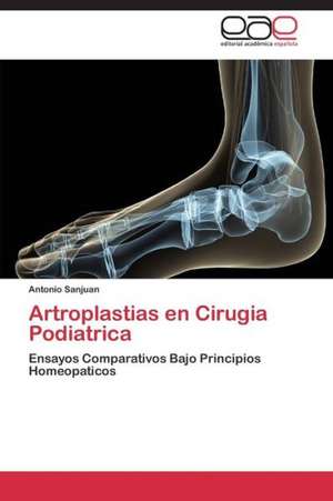 Artroplastias en Cirugia Podiatrica de Antonio Sanjuan