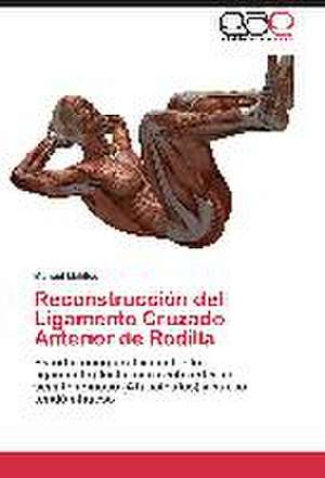 Reconstrucción del Ligamento Cruzado Anterior de Rodilla de Manuel Malillos