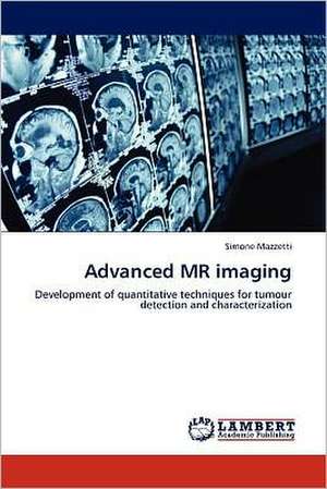 Advanced MR imaging de Simone Mazzetti