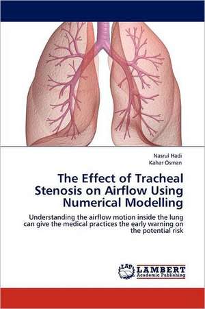 The Effect of Tracheal Stenosis on Airflow Using Numerical Modelling de Nasrul Hadi