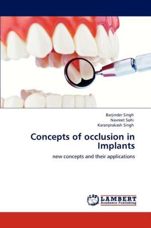 Concepts of occlusion in Implants de Barjinder Singh