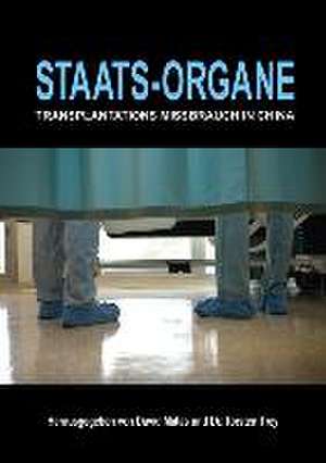 Staats-Organe de David Matas