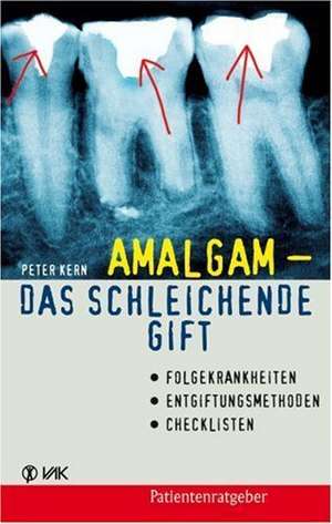 Amalgam - das schleichende Gift de Peter Kern