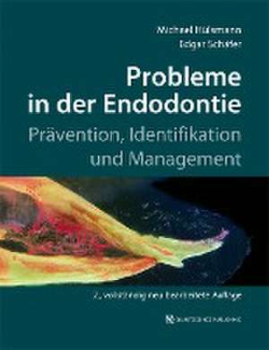 Probleme in der Endodontie de Michael Hülsmann