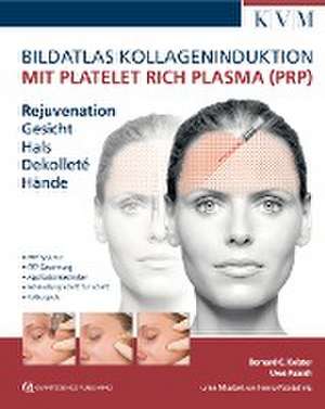 Bildatlas Kollageninduktion mit Platelet Rich Plasma (PRP) de Uwe Paasch