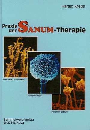 Praxis der SANUM-Therapie de Harald Krebs