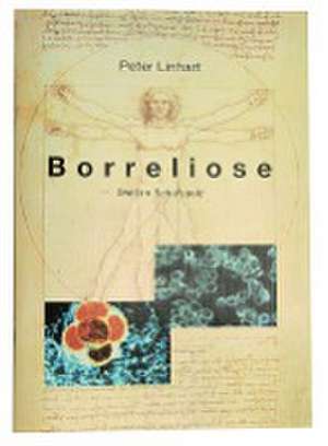 Borreliose - Wolf im Schafspelz de Peter Linhart