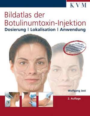 Bildatlas der Botulinumtoxin-Injektion de Wolfgang Jost