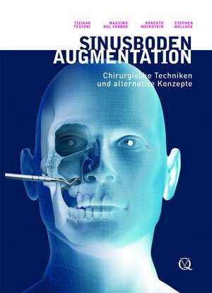 Sinusbodenaugmentation: Chirurgische Techniken und alternative Konzepte de Tiziano Testori