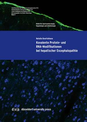 Kovalente Protein- und RNA-Modifikationen bei hepatischer Enzephalopathie de Natalia Qvartskhava