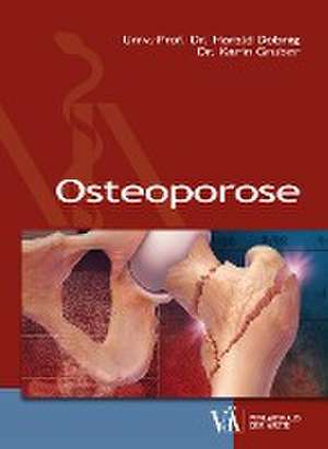 Osteoporose de Harald Dobnig