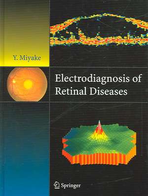 Electrodiagnosis of Retinal Disease de Yozo Miyake