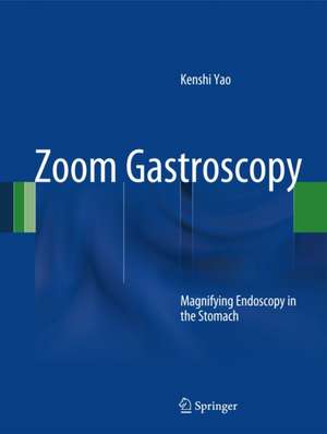 Zoom Gastroscopy: Magnifying Endoscopy in the Stomach de Kenshi Yao