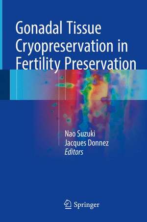 Gonadal Tissue Cryopreservation in Fertility Preservation de Nao Suzuki