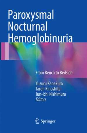 Paroxysmal Nocturnal Hemoglobinuria: From Bench to Bedside de Yuzuru Kanakura