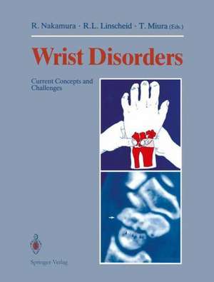 Wrist Disorders: Current Concepts and Challenges de Ryogo Nakamura