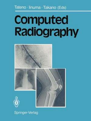 Computed Radiography de Yukio Tateno