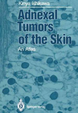 Adnexal Tumors of the Skin: An Atlas de Kinya Ishikawa