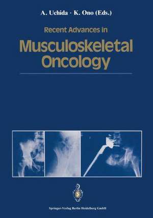 Recent Advances in Musculoskeletal Oncology de Atsumasa Uchida