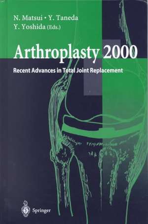 Arthroplasty 2000: Recent Advances in Total Joint Replacement de N. Matsui