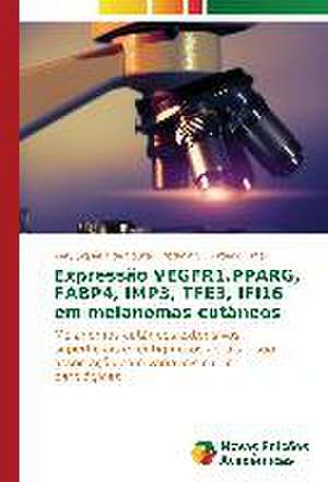 Expressao Vegfr1, Pparg, Fabp4, Imp3, Tfe3, Ifi16 Em Melanomas Cutaneos: Conflitos Conjugais E Qualidade de Vida de Kelly Siqueira de Souza