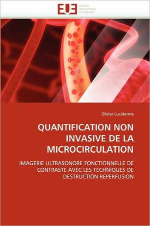 Quantification Non Invasive de La Microcirculation de Olivier Lucidarme