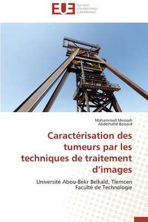 Caracterisation Des Tumeurs Par Les Techniques de Traitement D Images