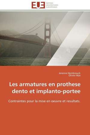 Les Armatures En Prothese Dento Et Implanto-Portee: Besoins de Formation En France de Jeremie Hombrouck