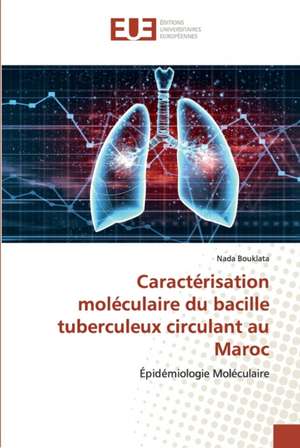 Caractérisation moléculaire du bacille tuberculeux circulant au Maroc de Nada Bouklata