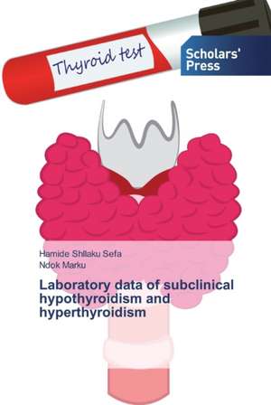 Laboratory data of subclinical hypothyroidism and hyperthyroidism de Hamide Shllaku Sefa