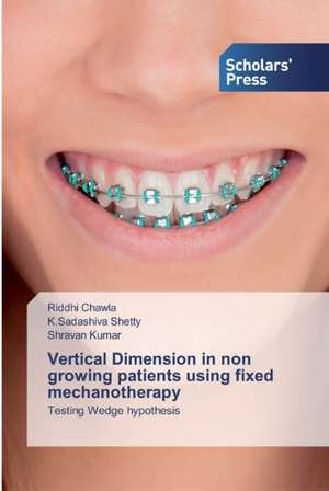 Vertical Dimension in non growing patients using fixed mechanotherapy de Riddhi Chawla