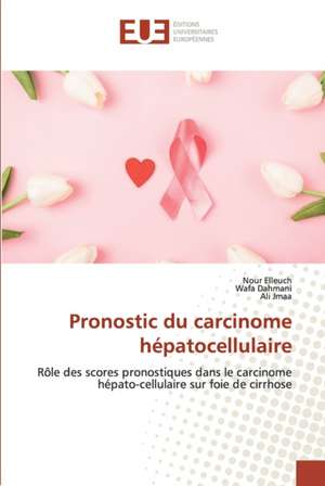 Pronostic du carcinome hépatocellulaire de Nour Elleuch