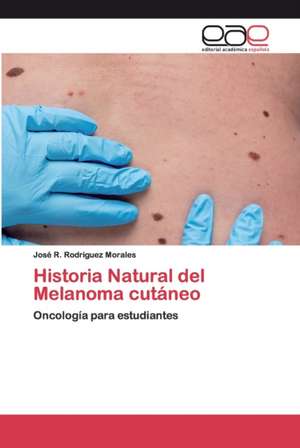 Historia Natural del Melanoma cutáneo de José R. Rodriguez Morales