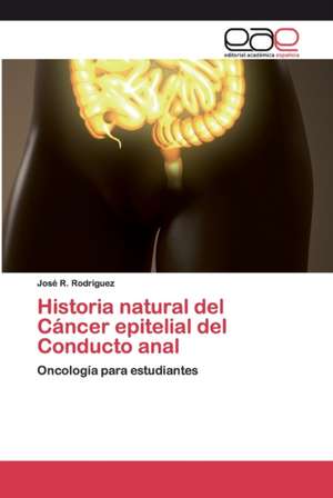 Historia natural del Cáncer epitelial del Conducto anal de José R. Rodriguez