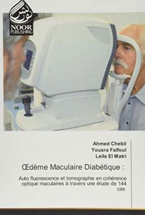 ¿dème Maculaire Diabétique : de Ahmed Chebil