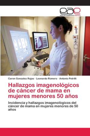 Hallazgos imagenológicos de cáncer de mama en mujeres menores 50 años de Caren Gonzalez Rojas