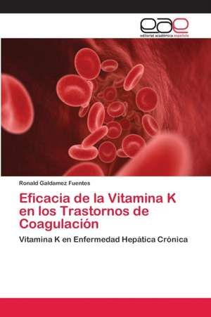 Eficacia de la Vitamina K en los Trastornos de Coagulación de Ronald Galdamez Fuentes